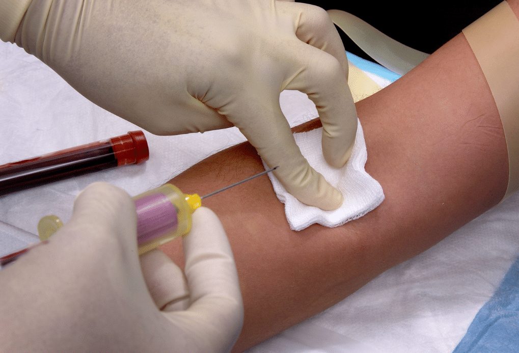 Phlebotomy: Peripheral Venepuncture for Upper Limbs 25